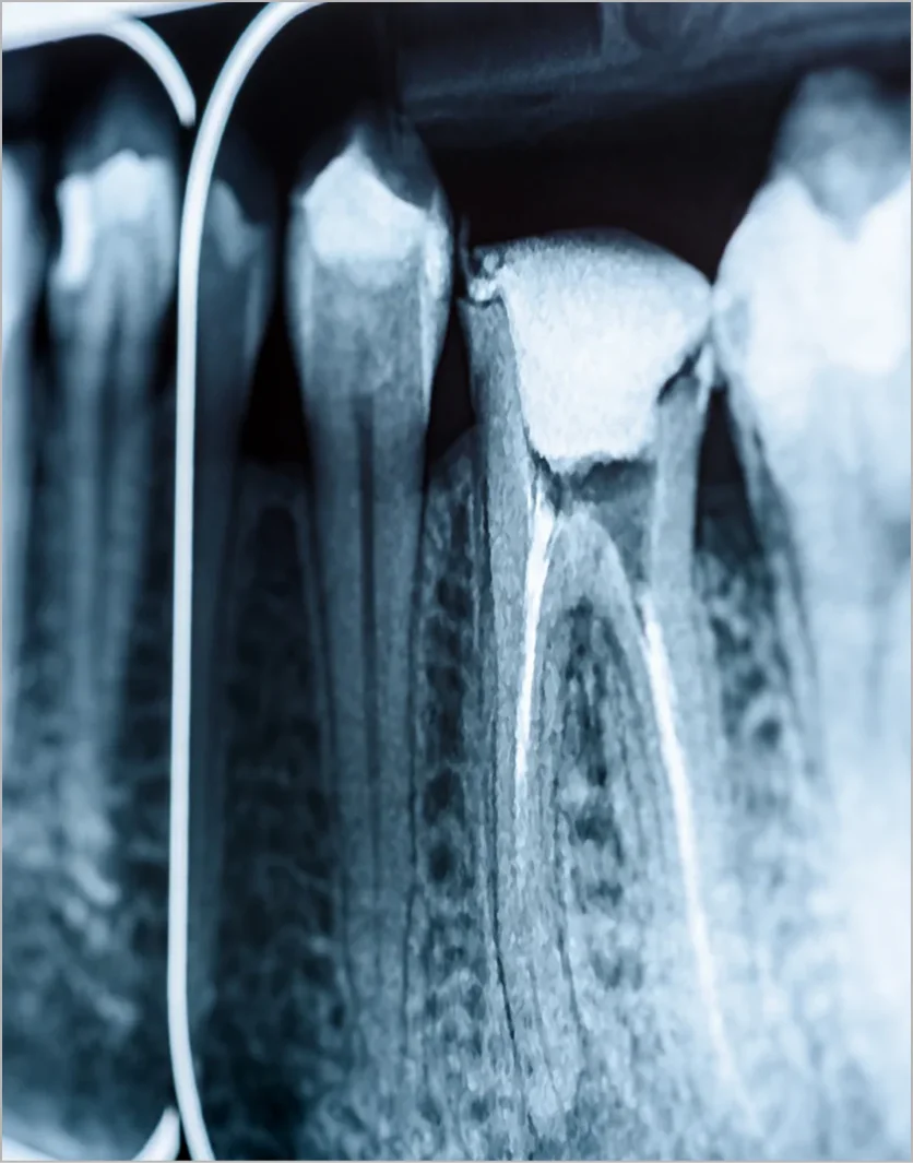 Facilities Bia X-Ray