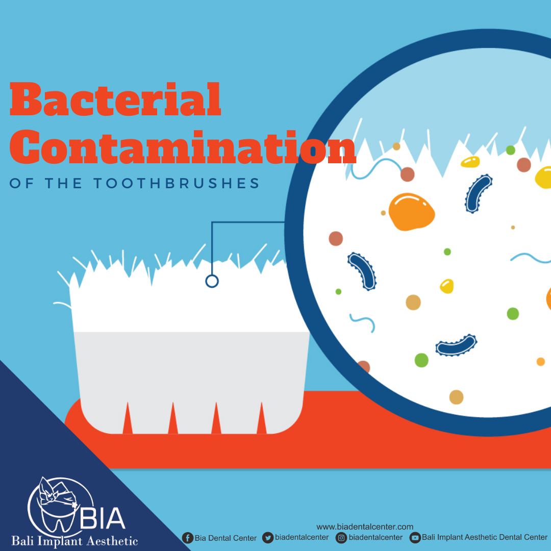 Blog Article Bia Dental