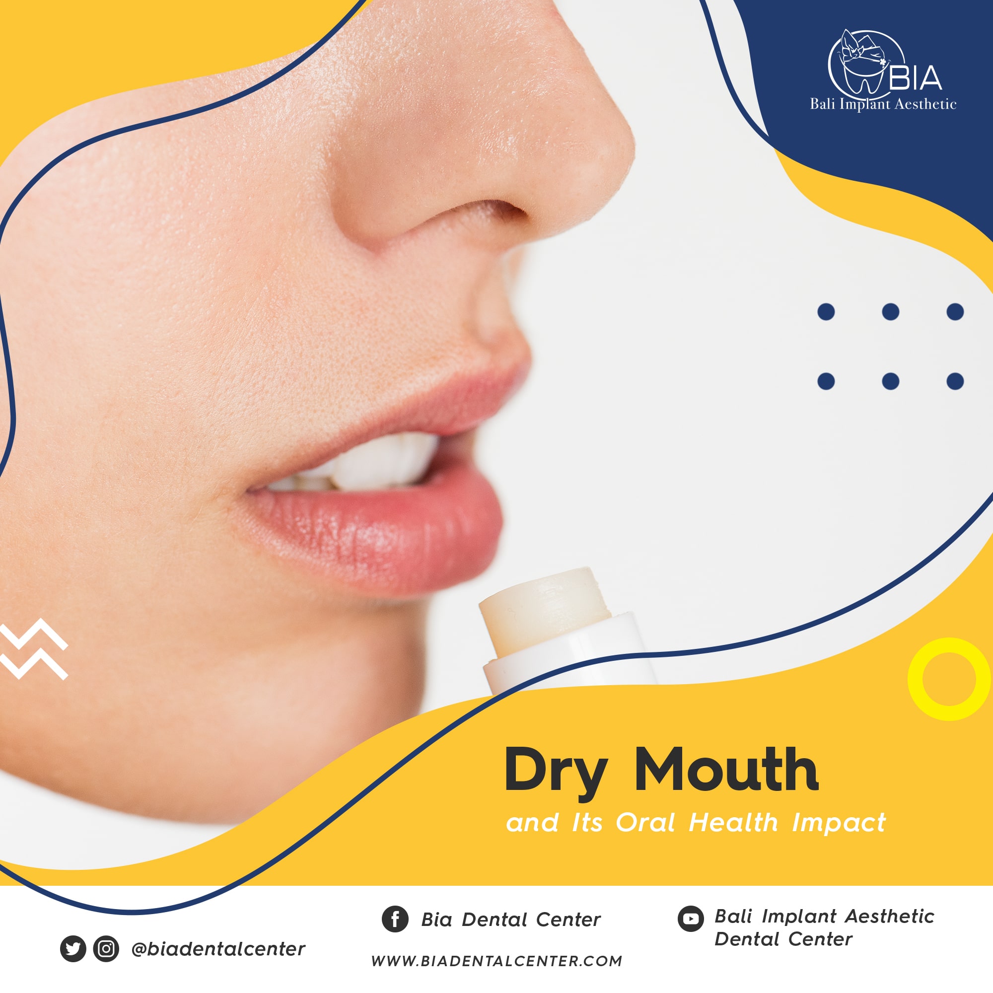 Blog Article Bia Dental