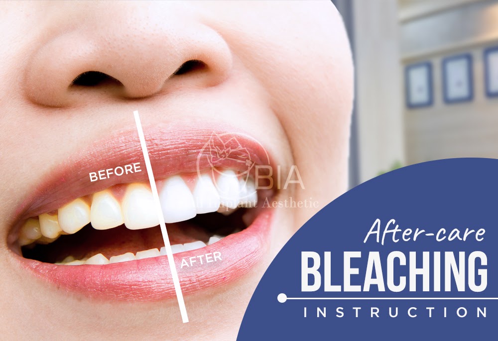 Blog Article Bia Dental