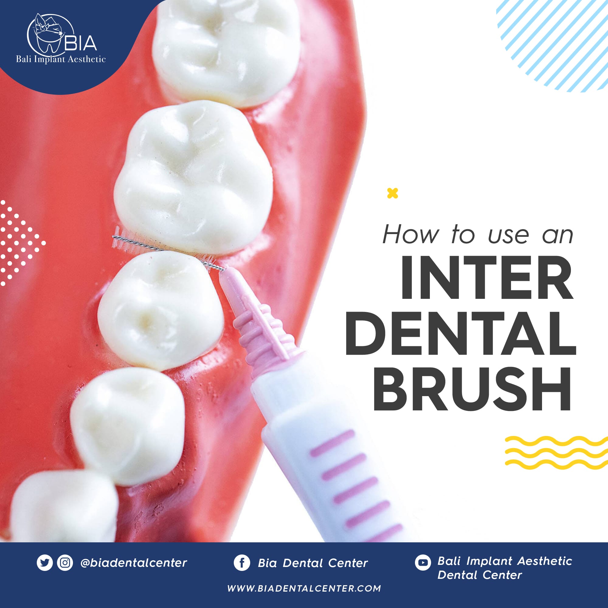 Blog Article Bia Dental