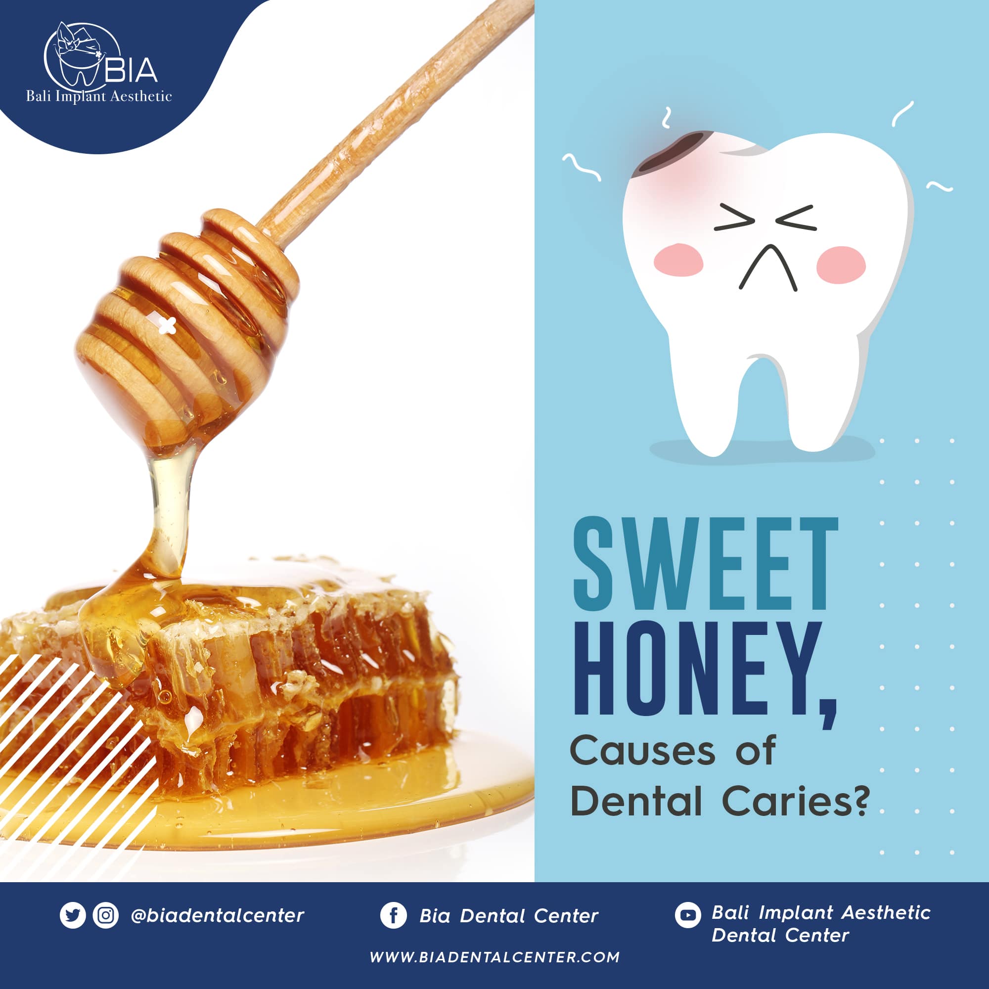 Blog Article Bia Dental