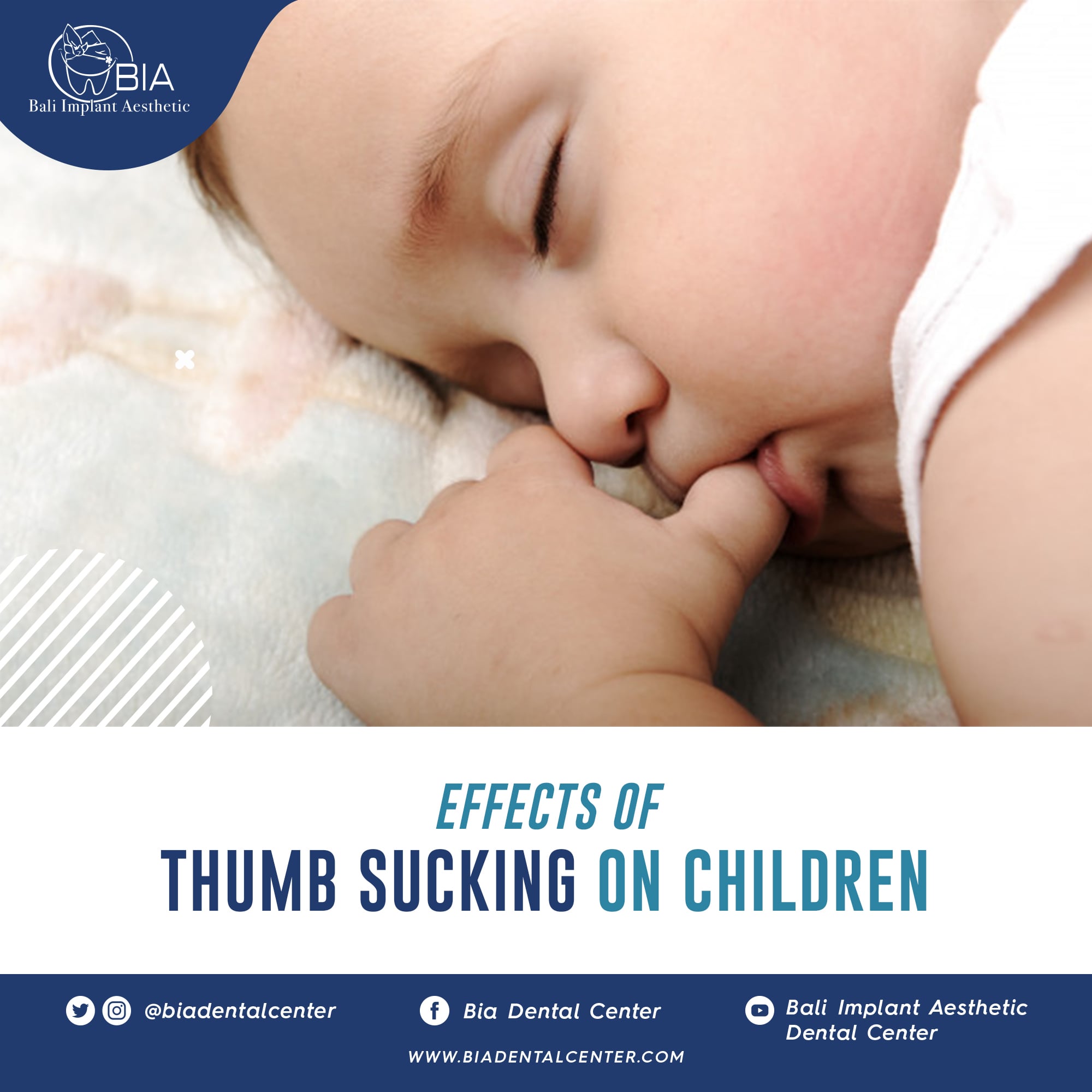 Blog Article Bia Dental