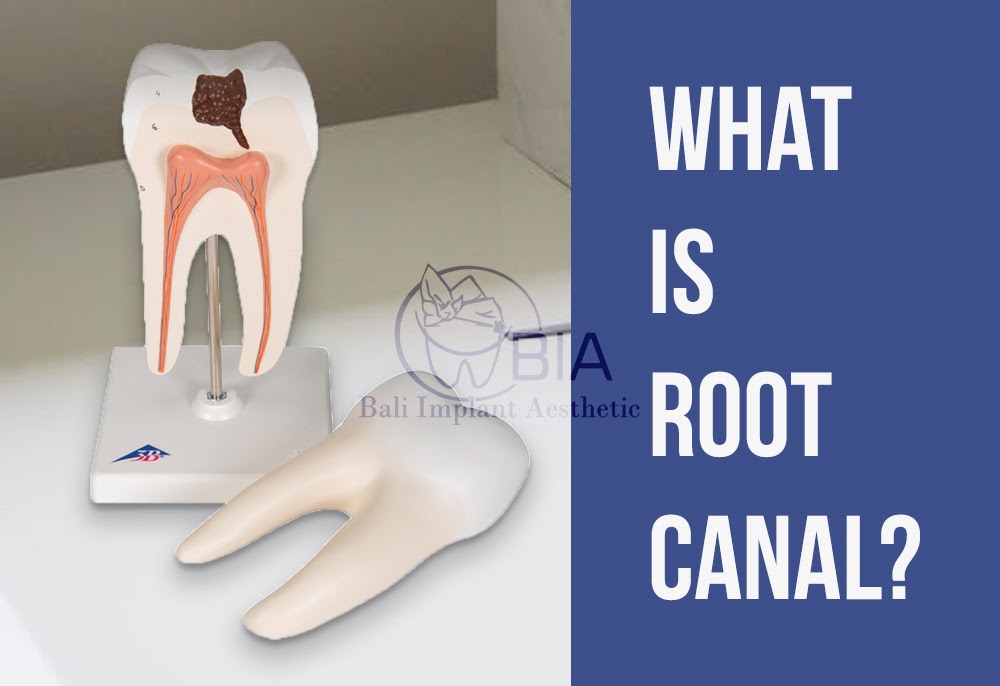 Blog Article Bia Dental