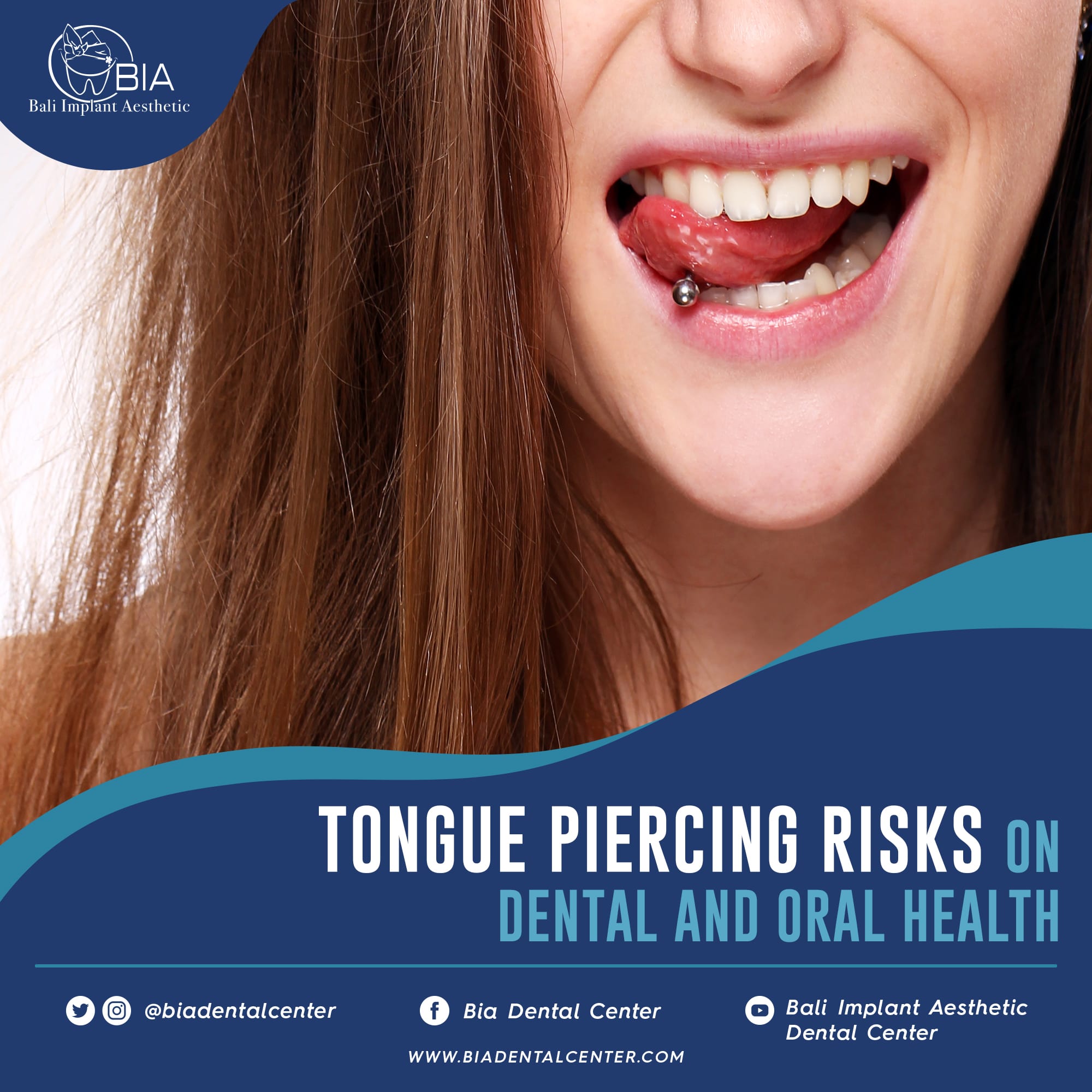 Blog Article Bia Dental