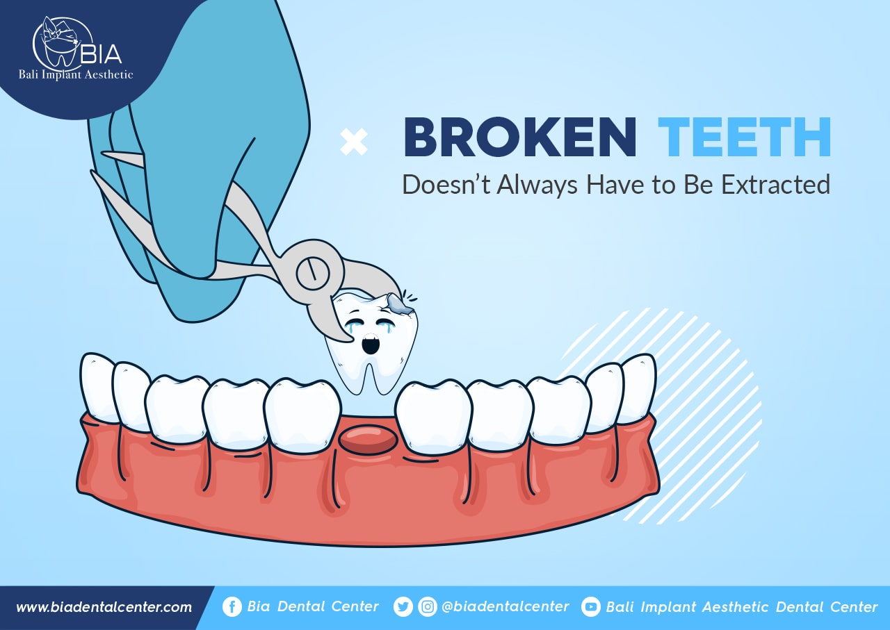 Blog Article Bia Dental