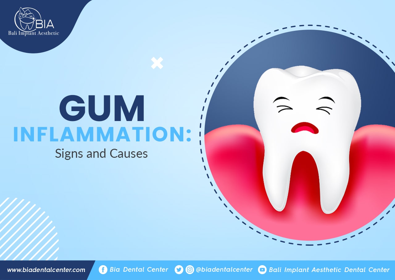 Blog Article Bia Dental