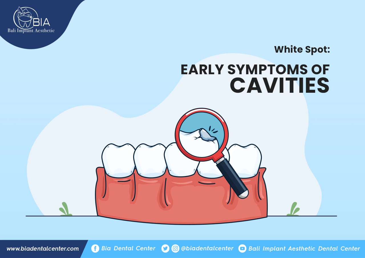 Blog Article Bia Dental