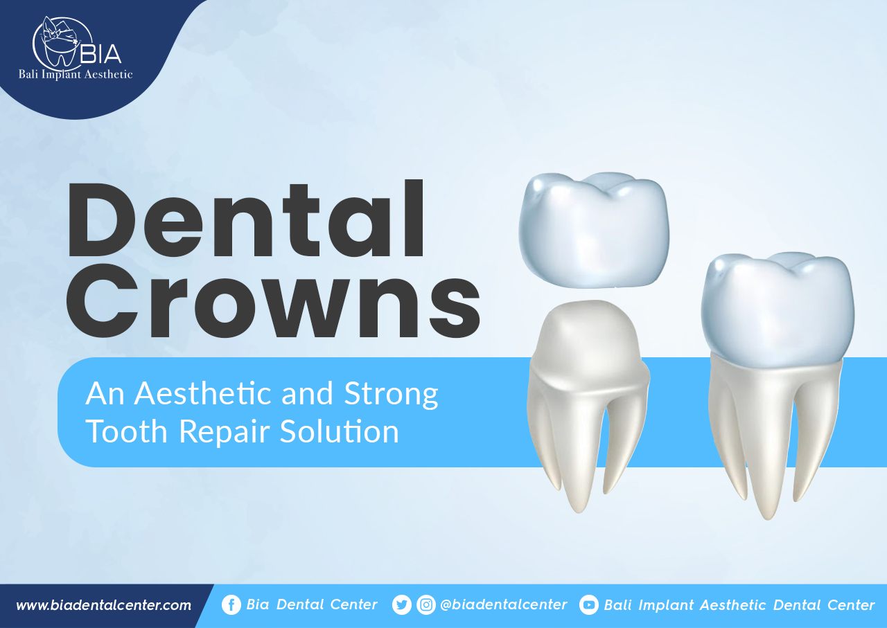 Blog Article Bia Dental