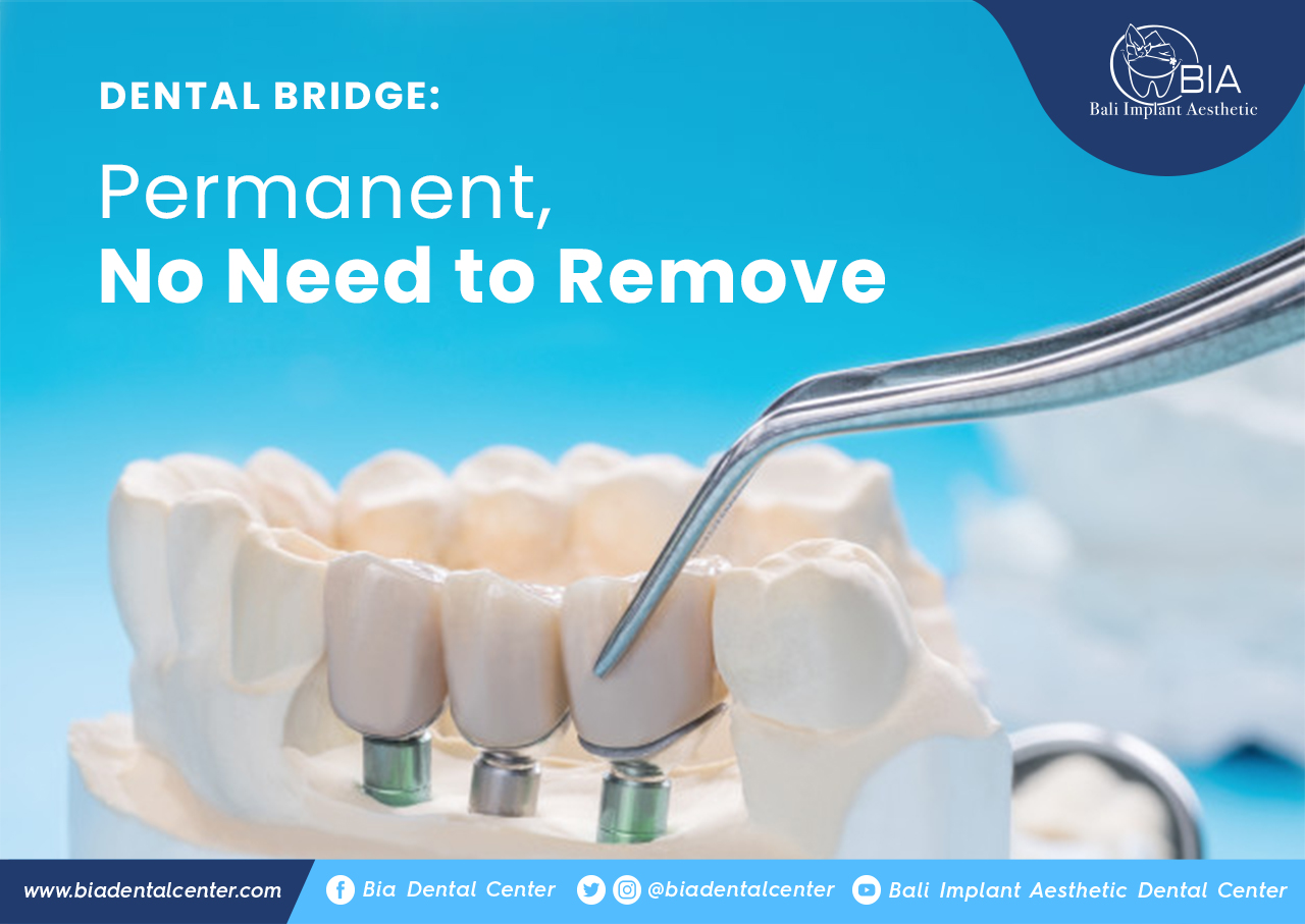 Blog Article Bia Dental