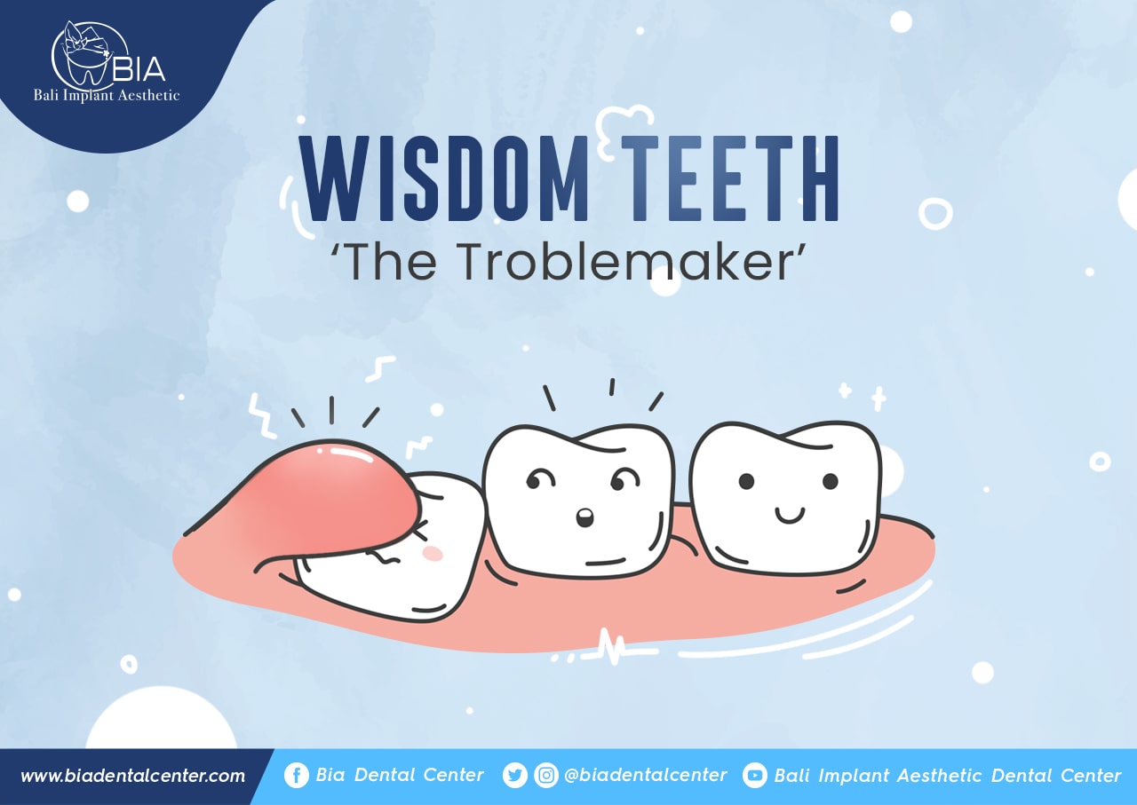 Blog Article Bia Dental