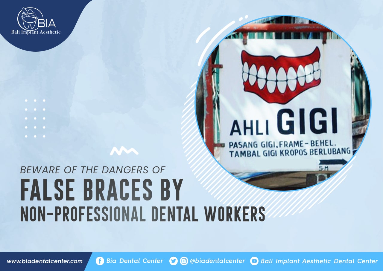 Blog Article Bia Dental