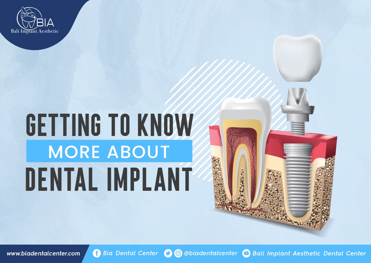 Blog Article Bia Dental