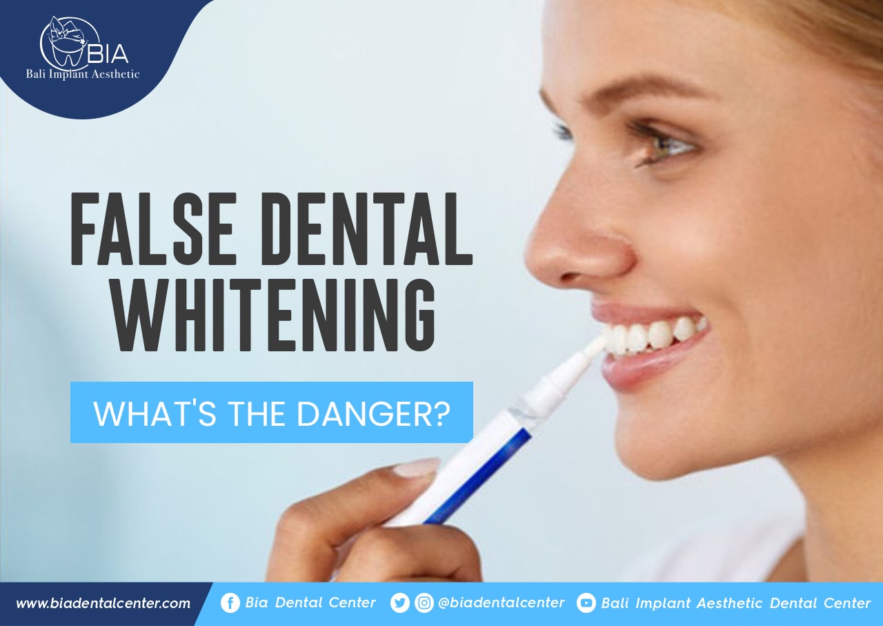 Blog Article Bia Dental