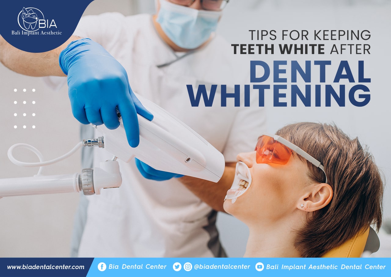 Blog Article Bia Dental