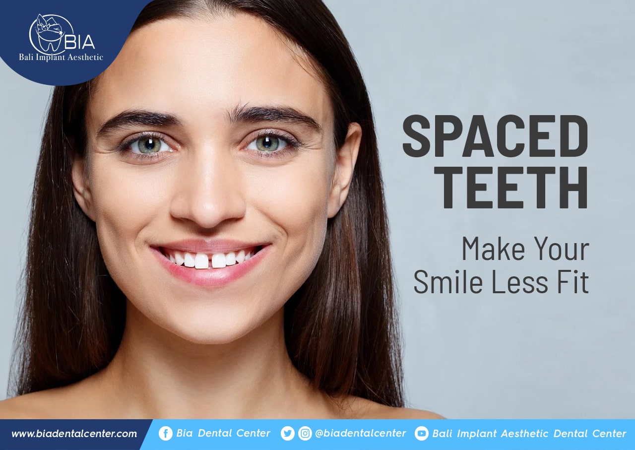 Blog Article Bia Dental