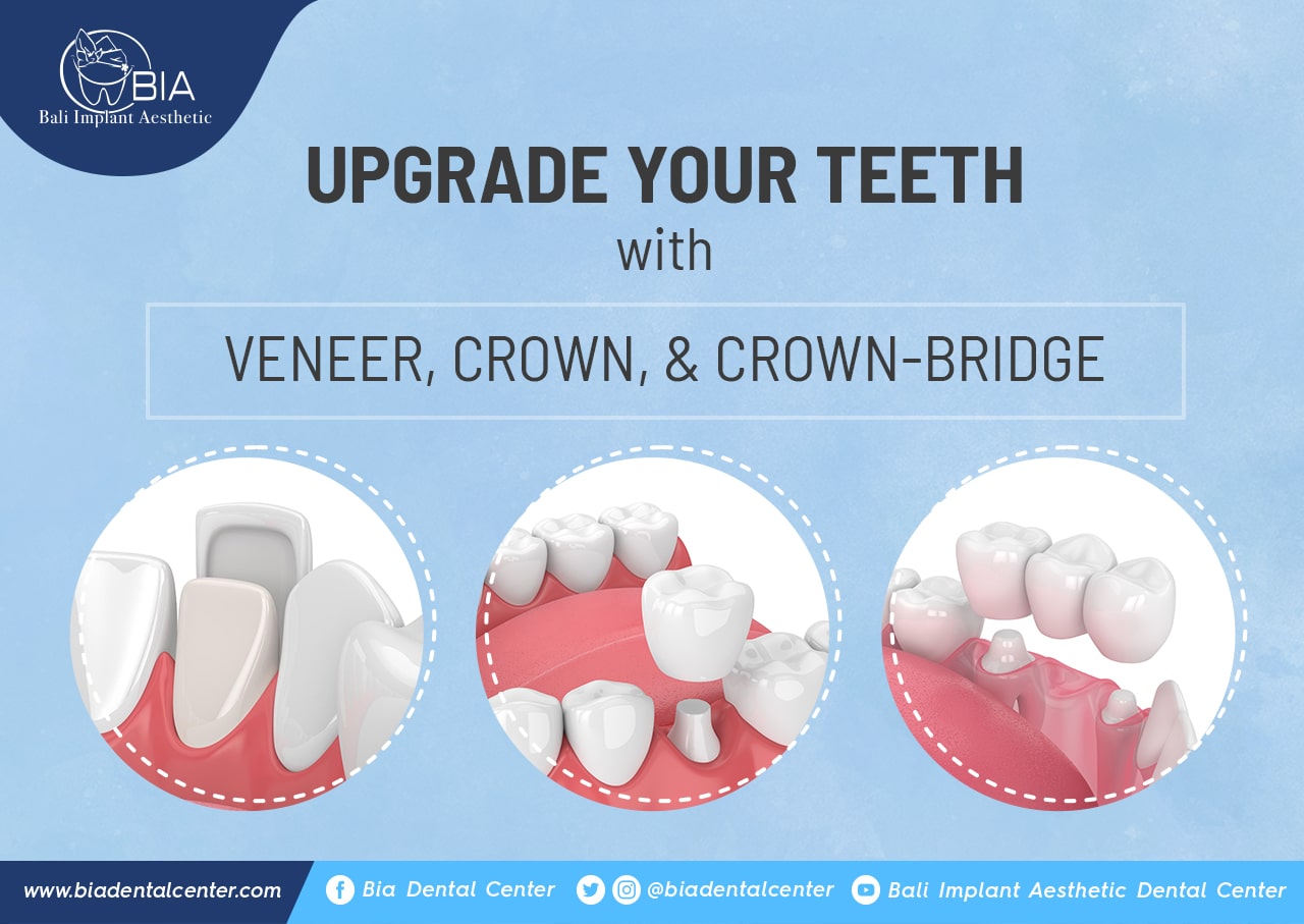 Blog Article Bia Dental