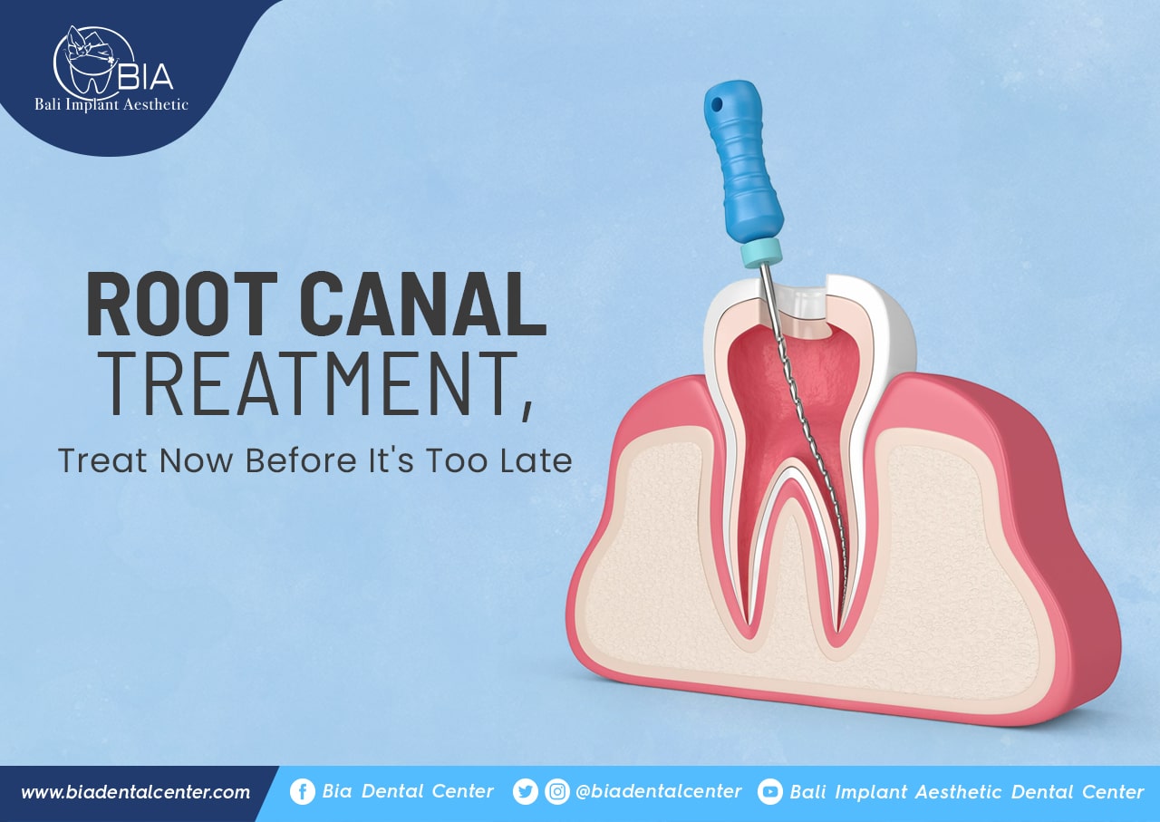 Blog Article Bia Dental