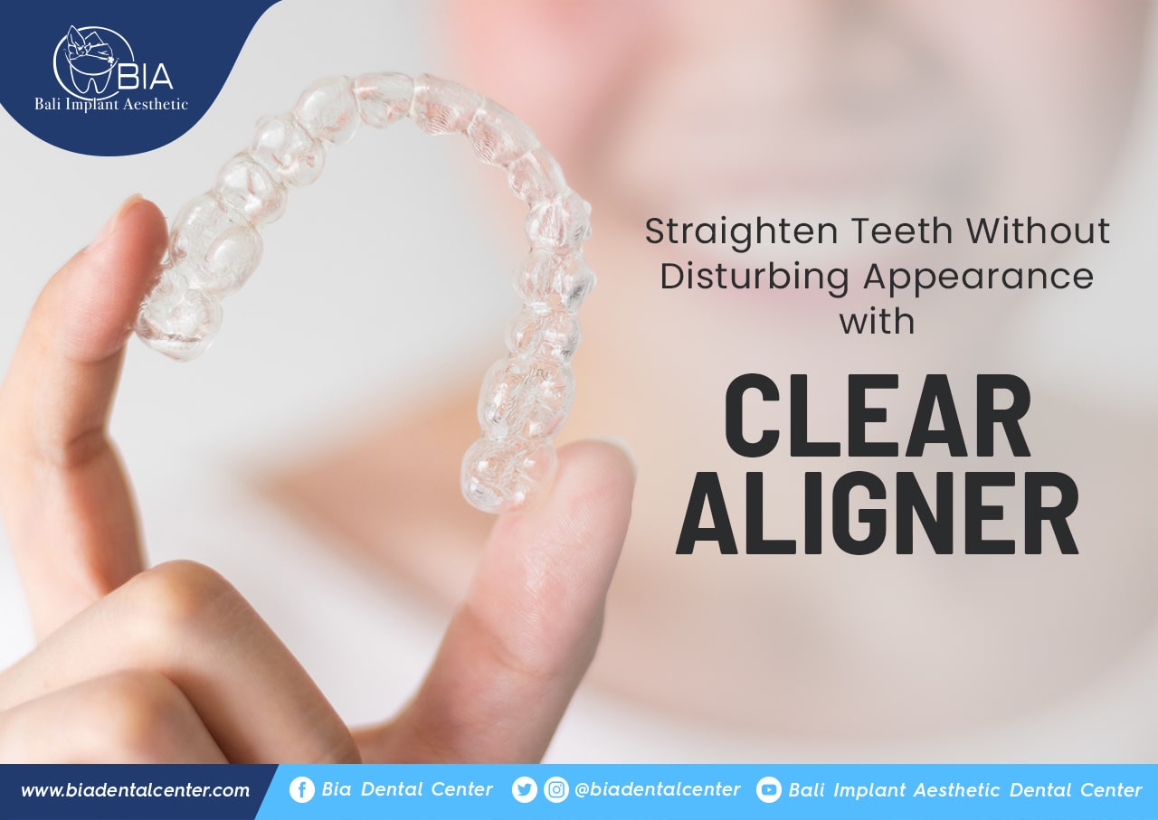 Blog Article Bia Dental