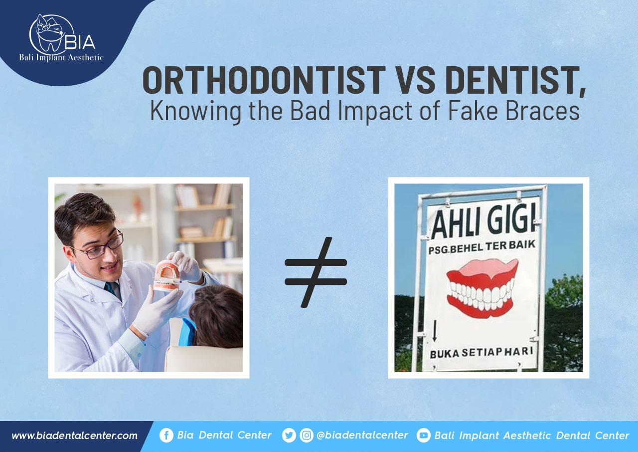 Blog Article Bia Dental