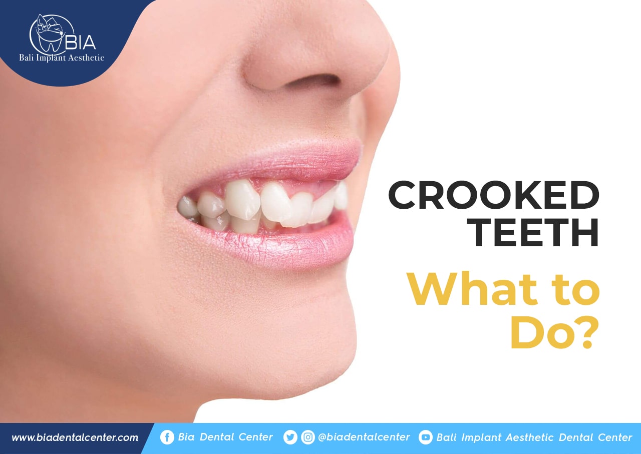 Blog Article Bia Dental