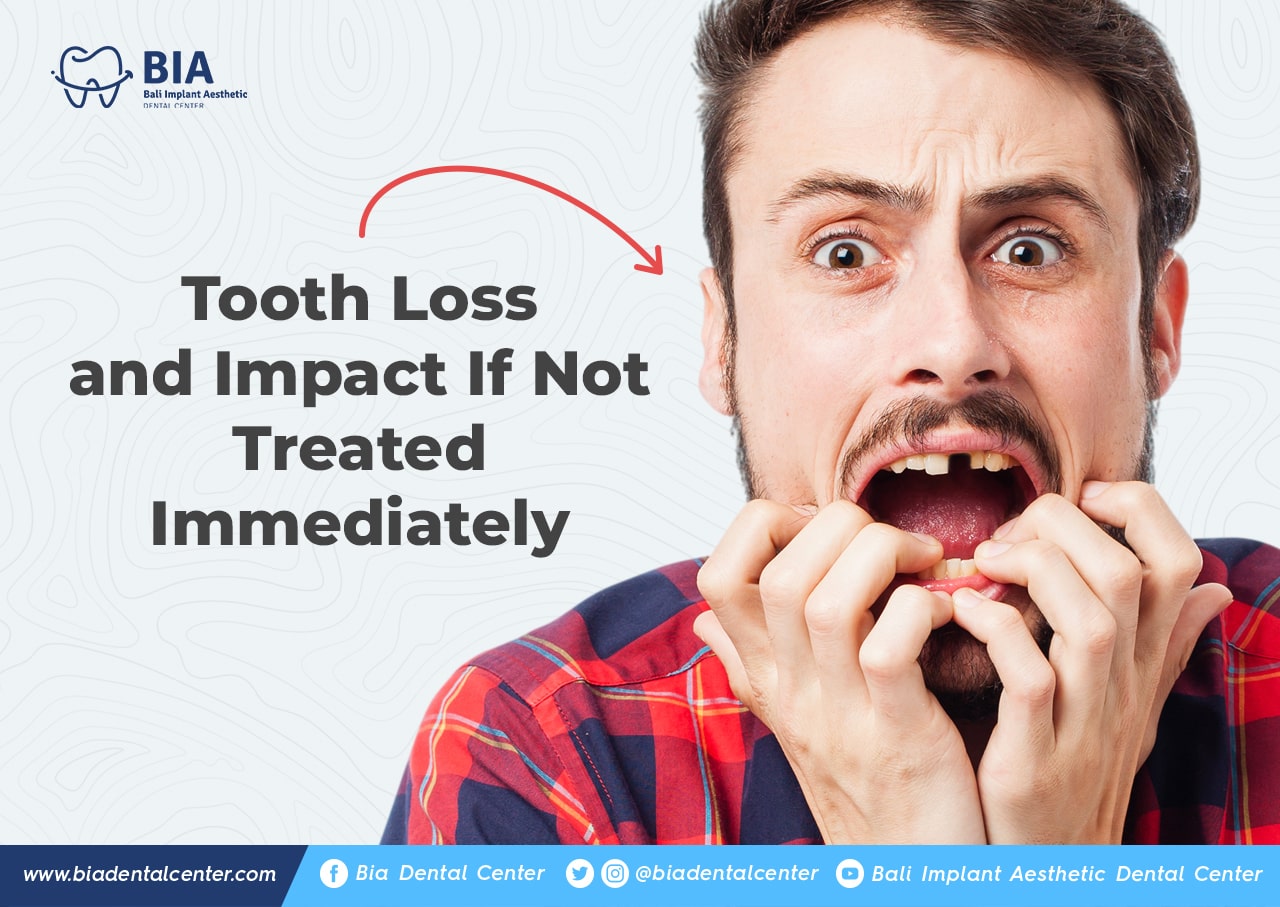 Blog Article Bia Dental