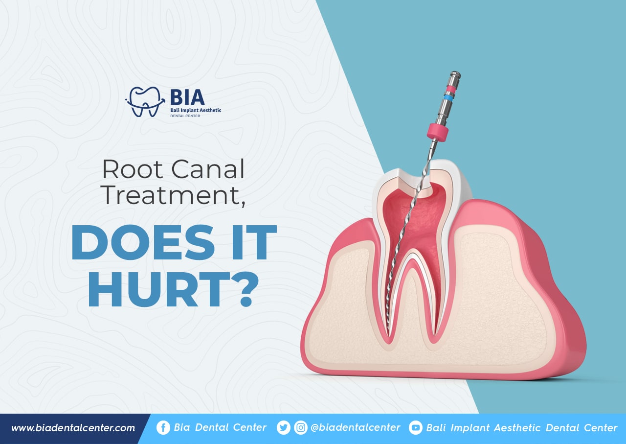 Blog Article Bia Dental