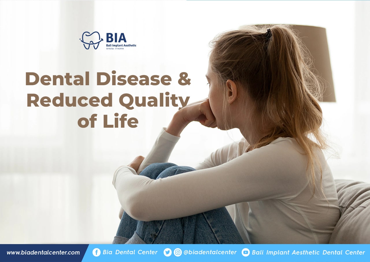Blog Article Bia Dental