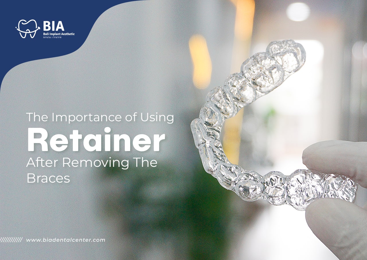 Blog Article Bia Dental