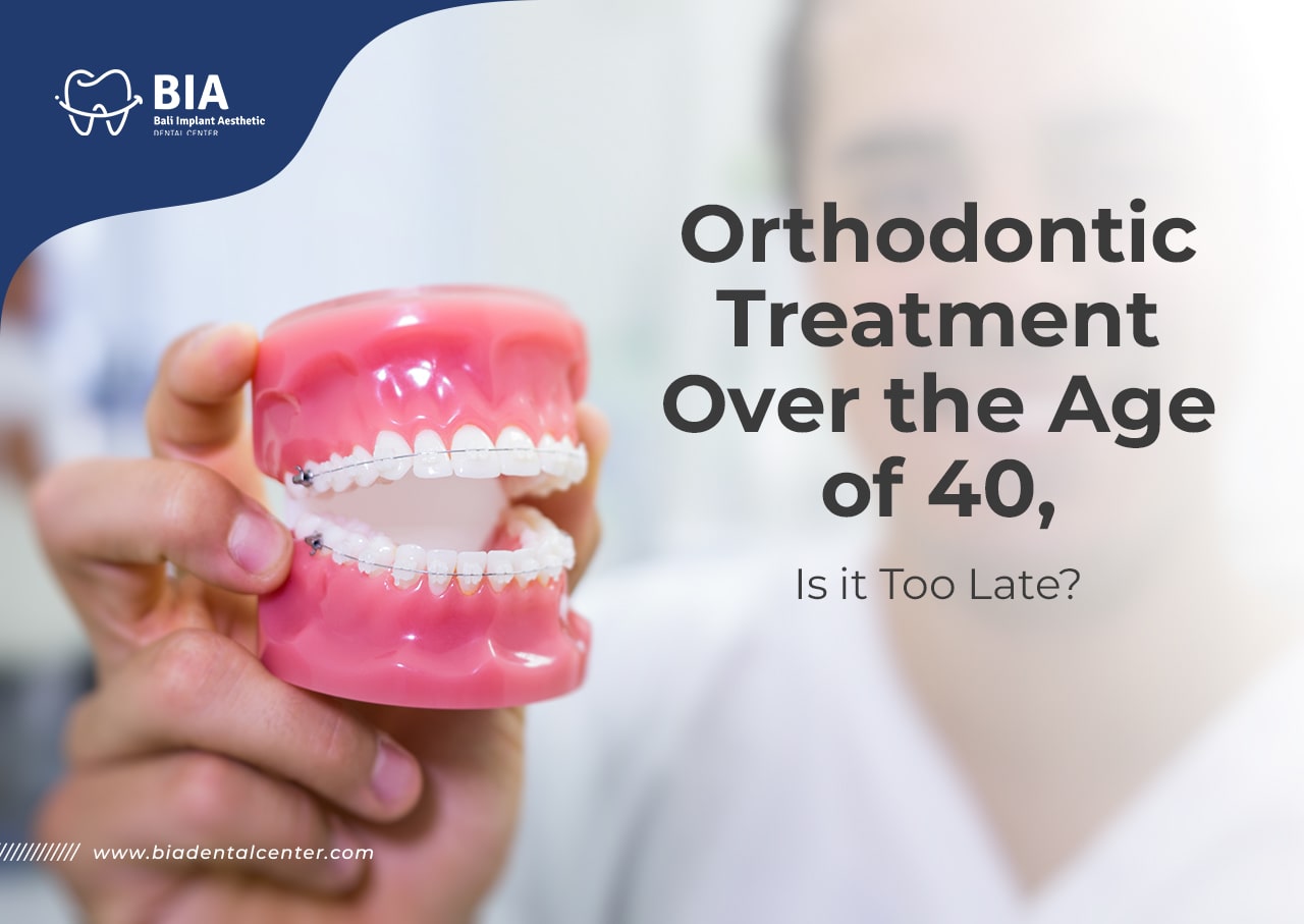 Blog Article Bia Dental