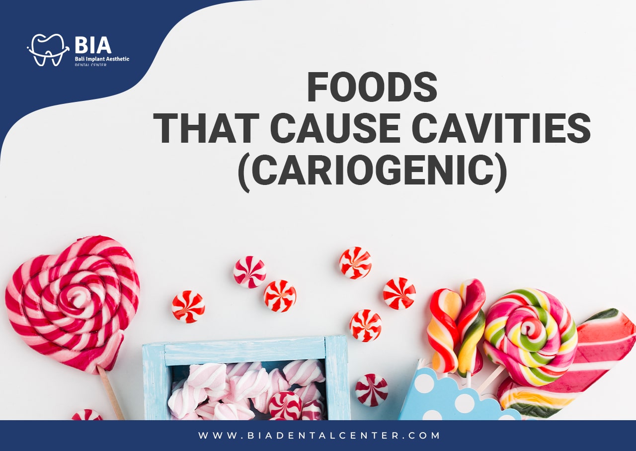 Blog Article Bia Dental