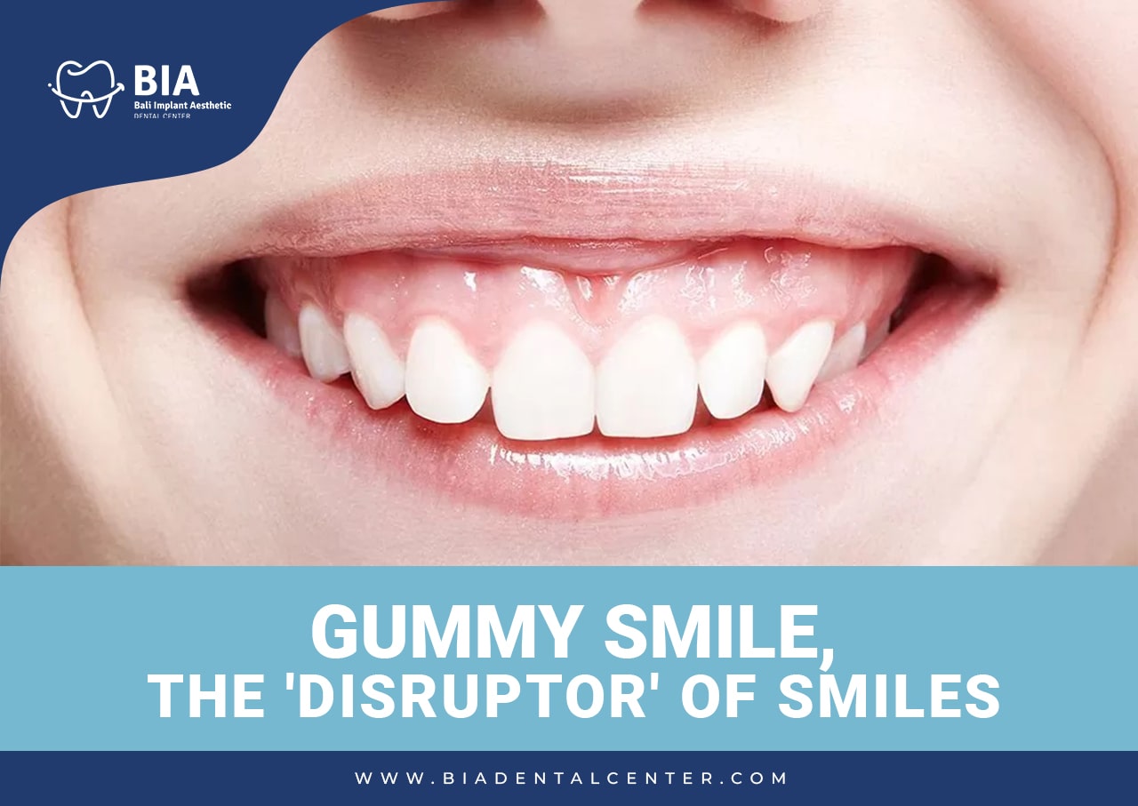 Blog Article Bia Dental