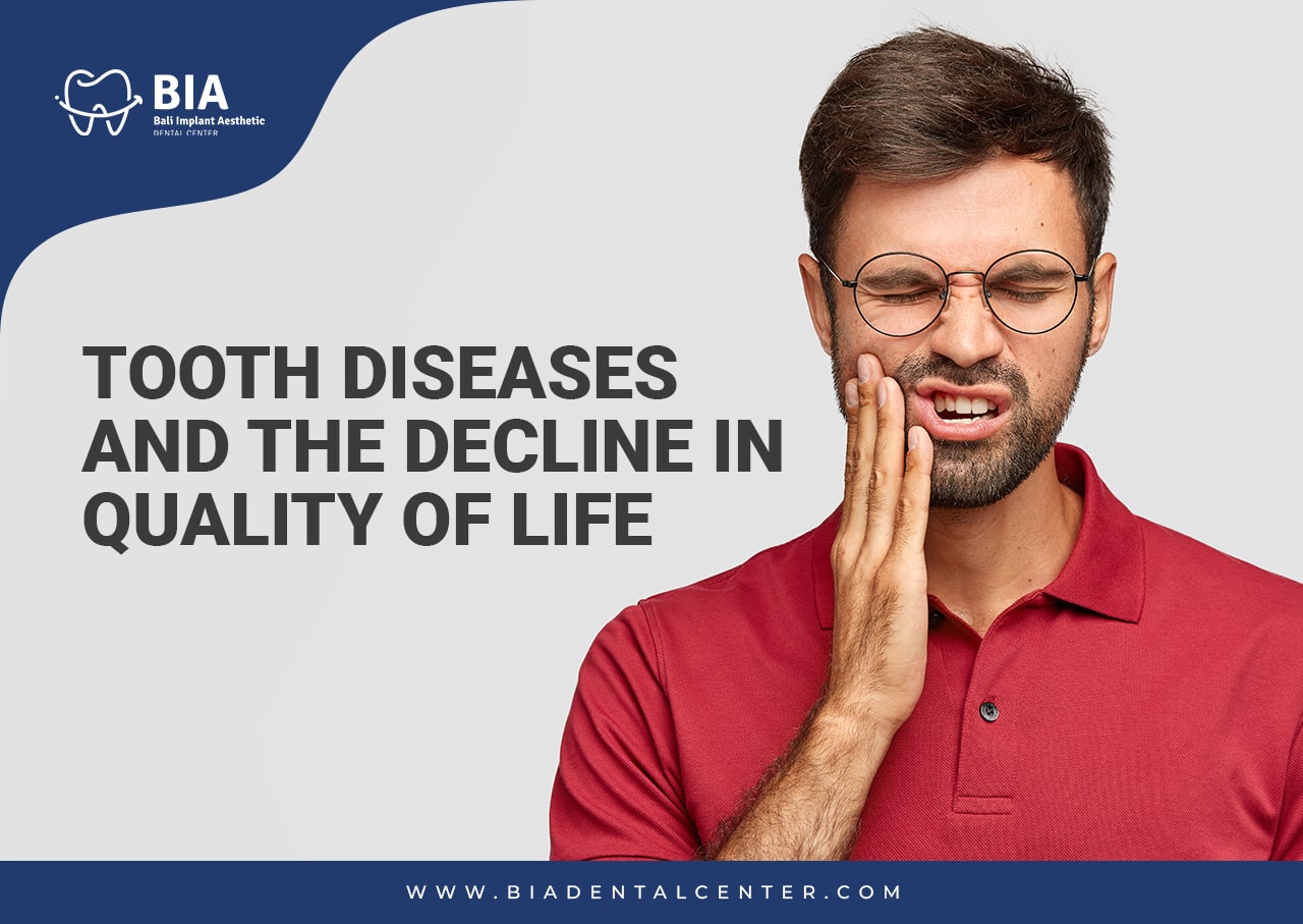 Blog Article Bia Dental