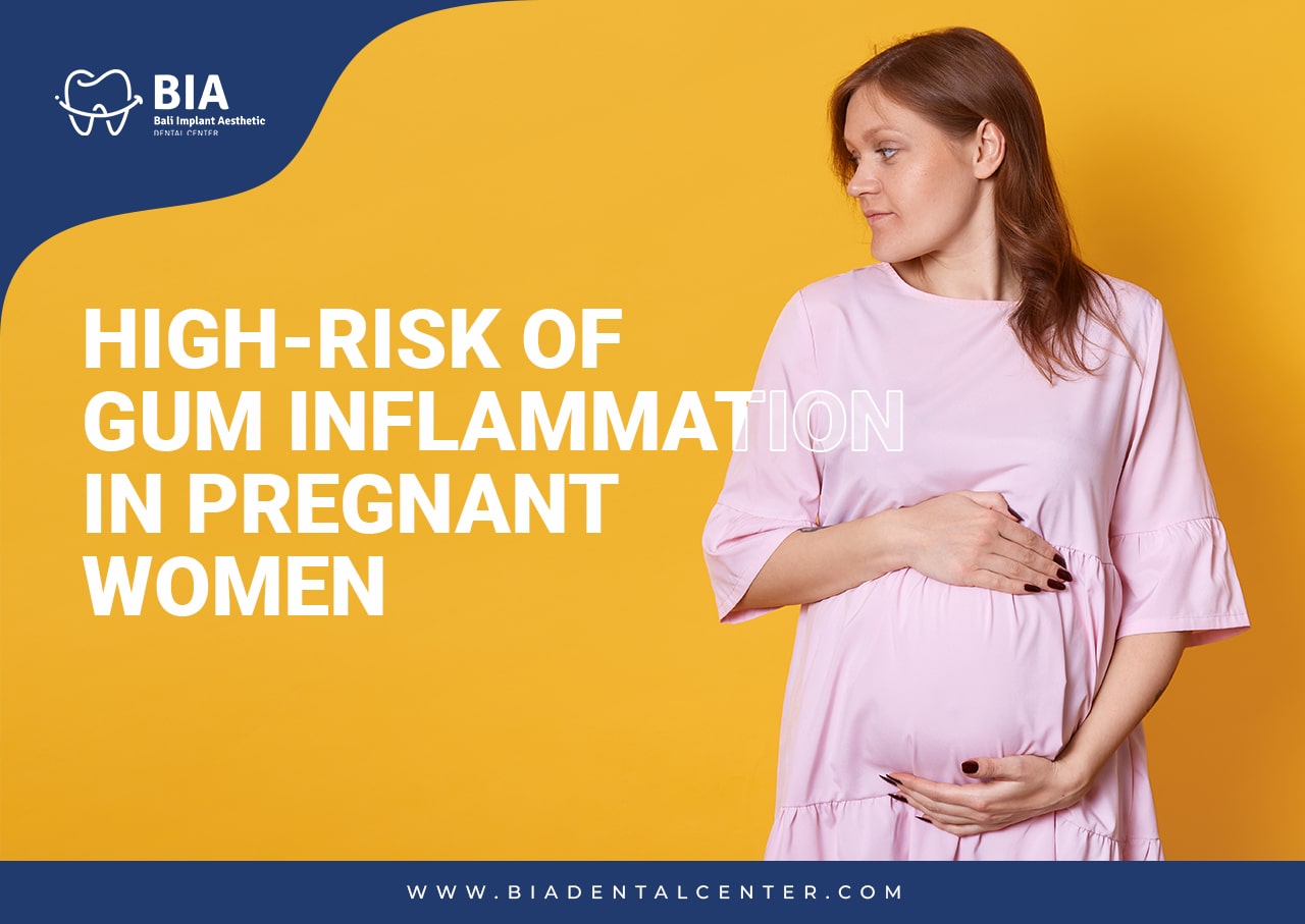 Blog Article Bia Dental