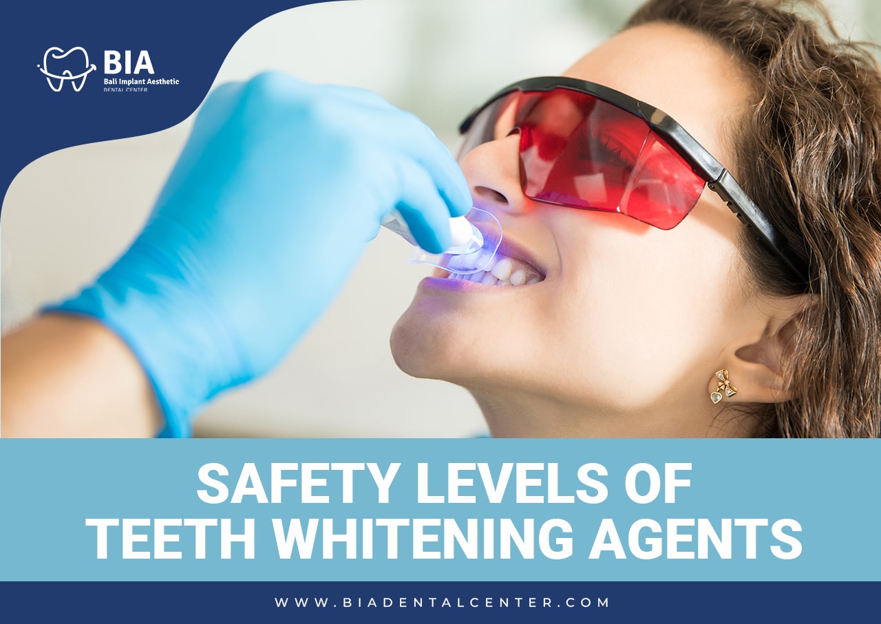 Blog Article Bia Dental