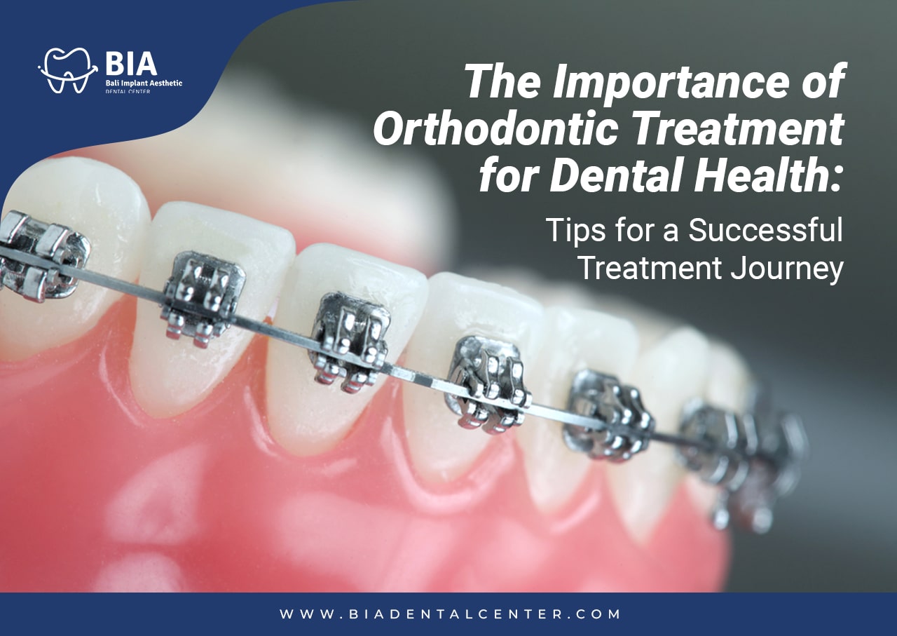 Blog Article Bia Dental