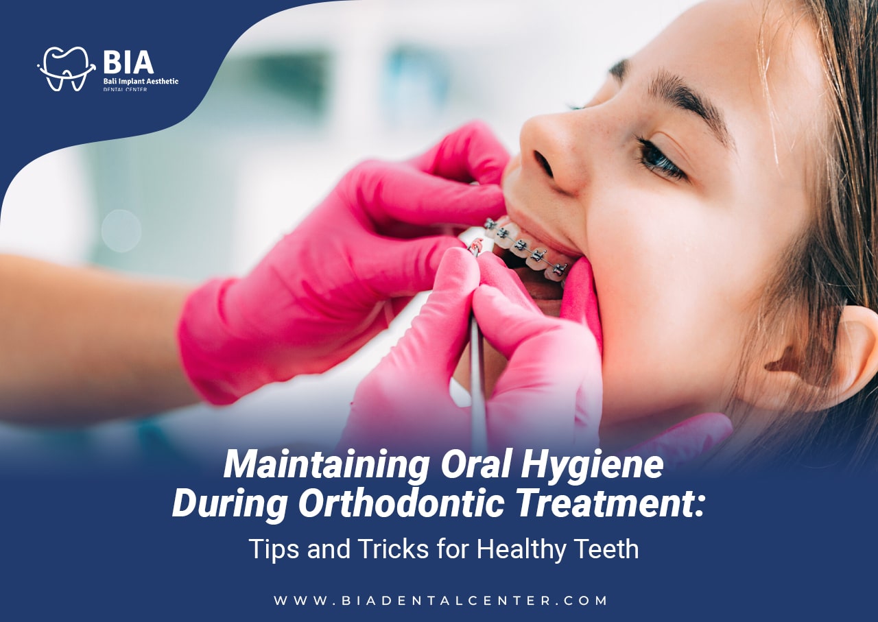 Blog Article Bia Dental