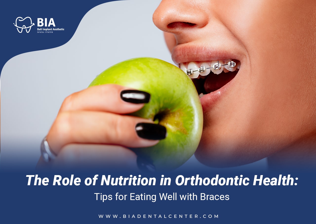 Blog Article Bia Dental