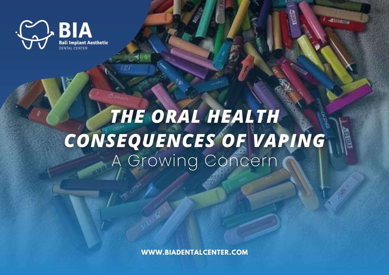 Blog Article Bia Dental