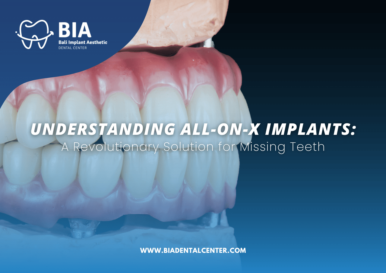 Blog Article Bia Dental