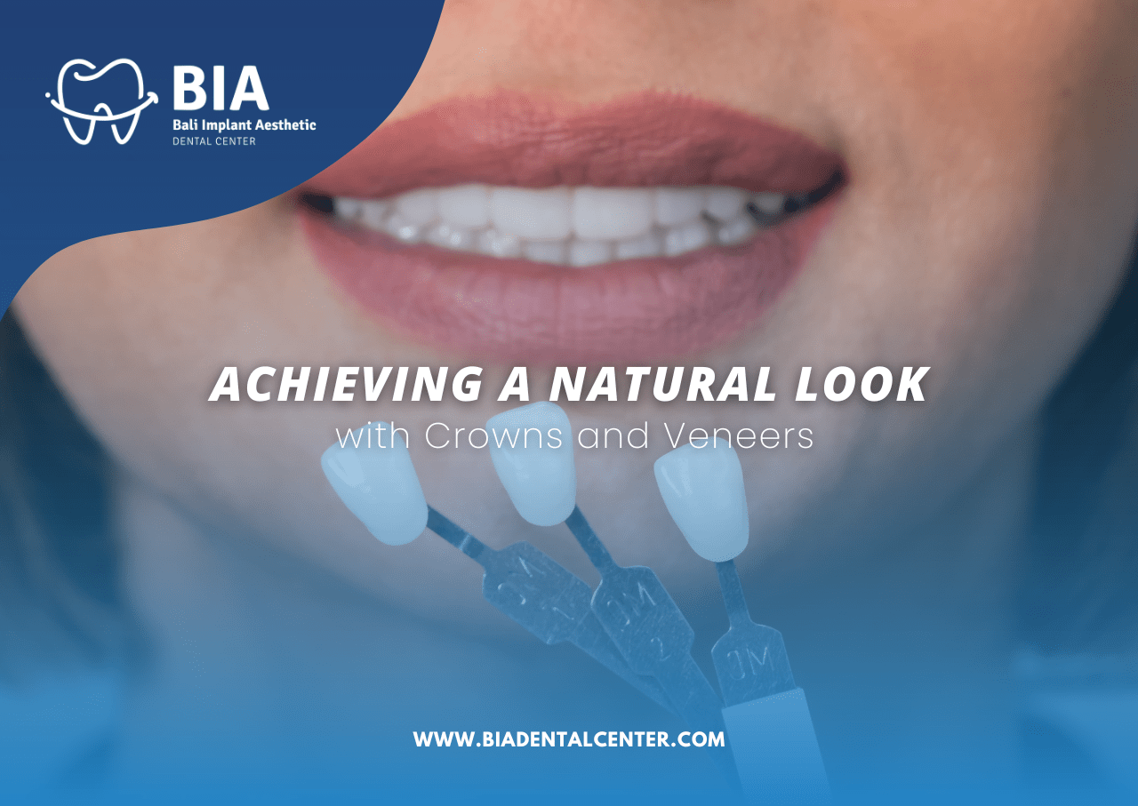 Blog Article Bia Dental