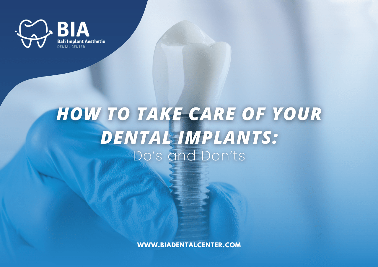 Blog Article Bia Dental