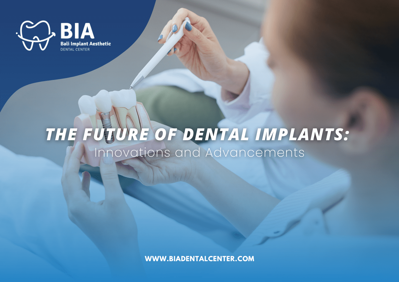 Blog Article Bia Dental