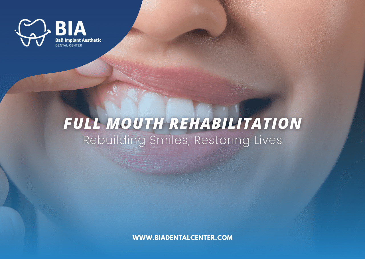 Blog Article Bia Dental