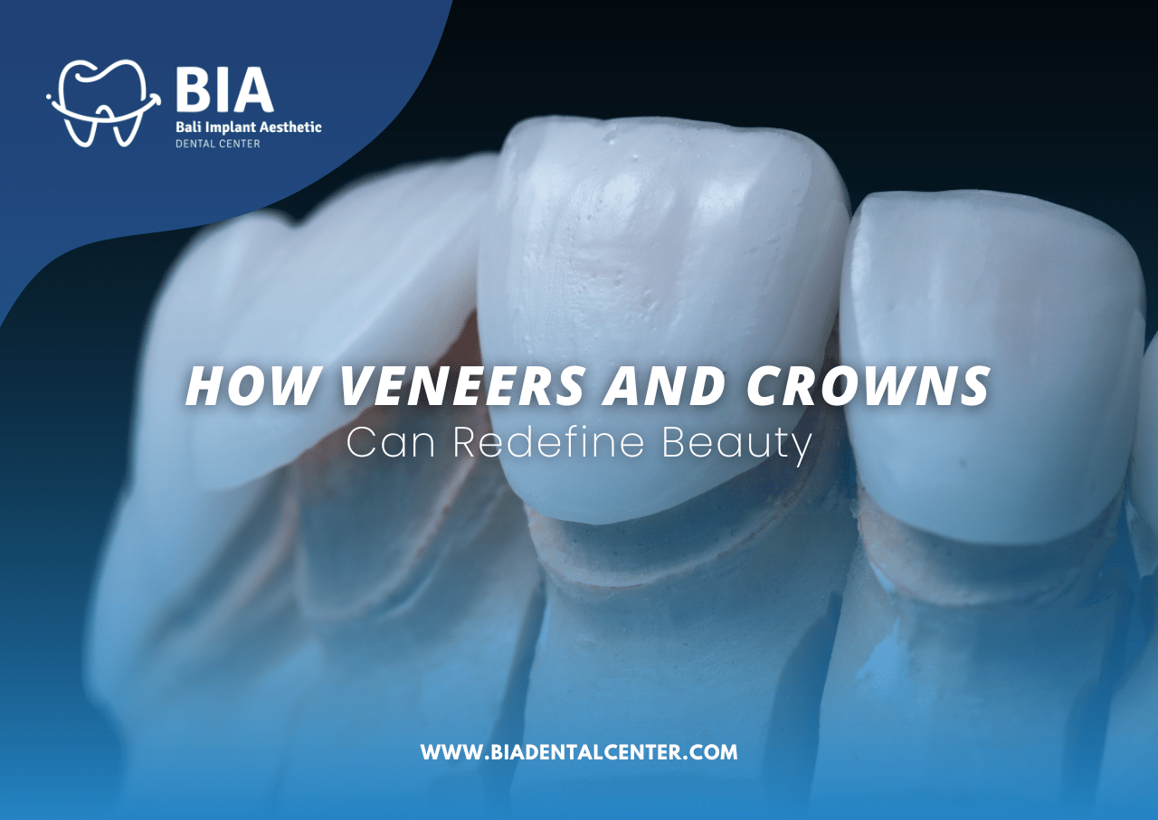 Blog Article Bia Dental