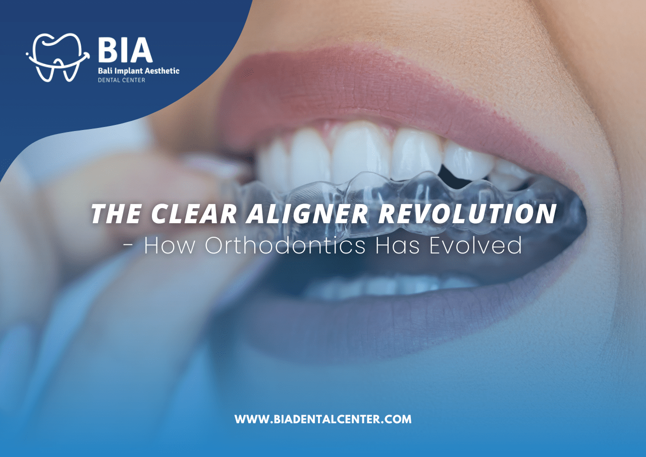 Blog Article Bia Dental