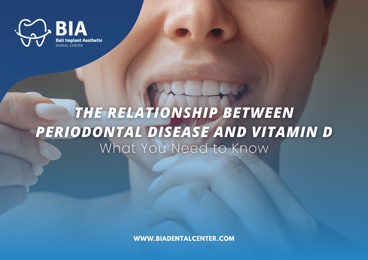 Blog Article Bia Dental