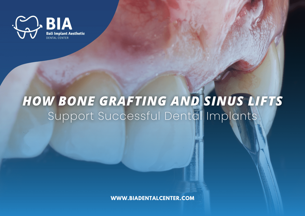 Blog Article Bia Dental