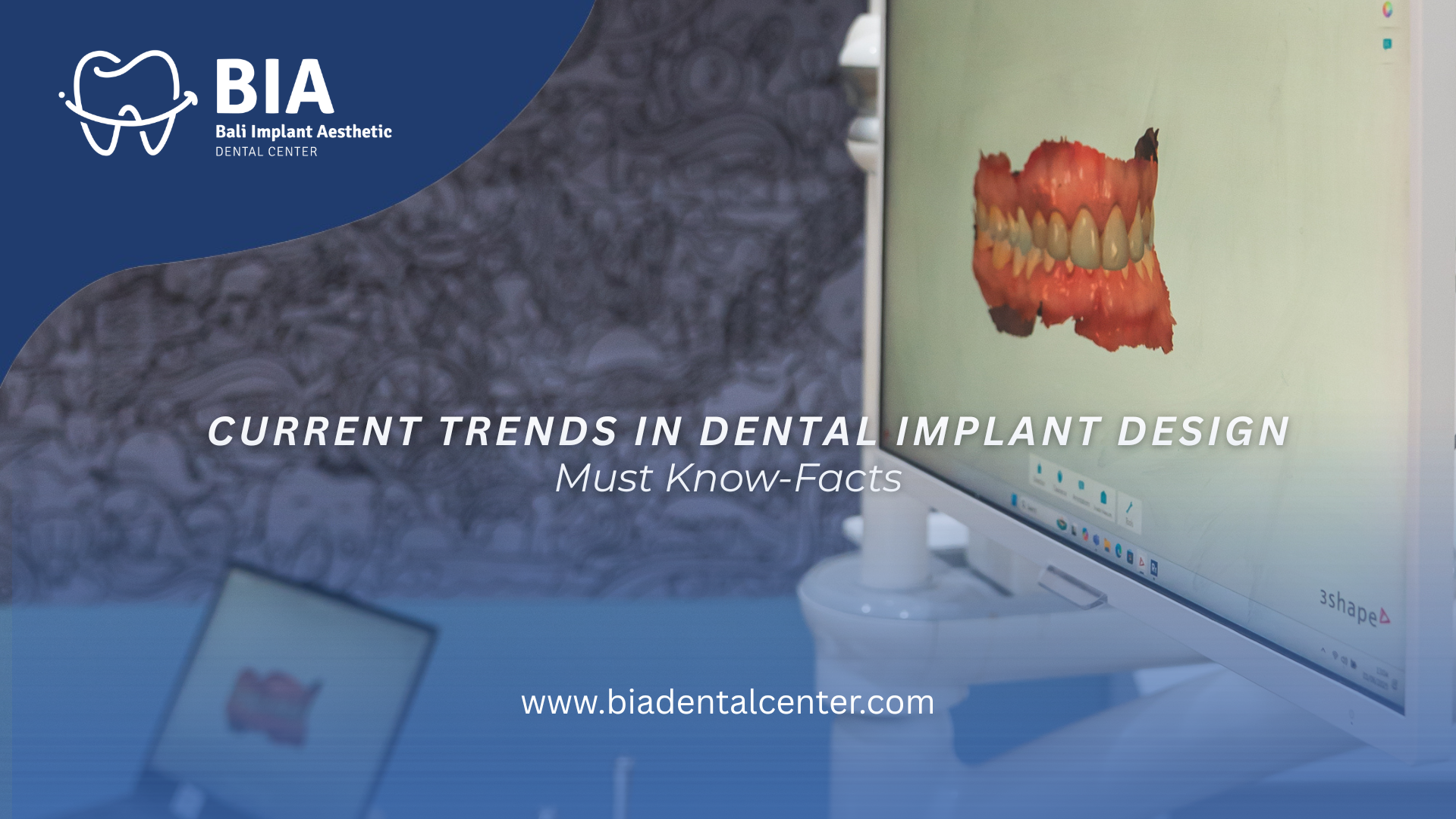 Blog Article Bia Dental