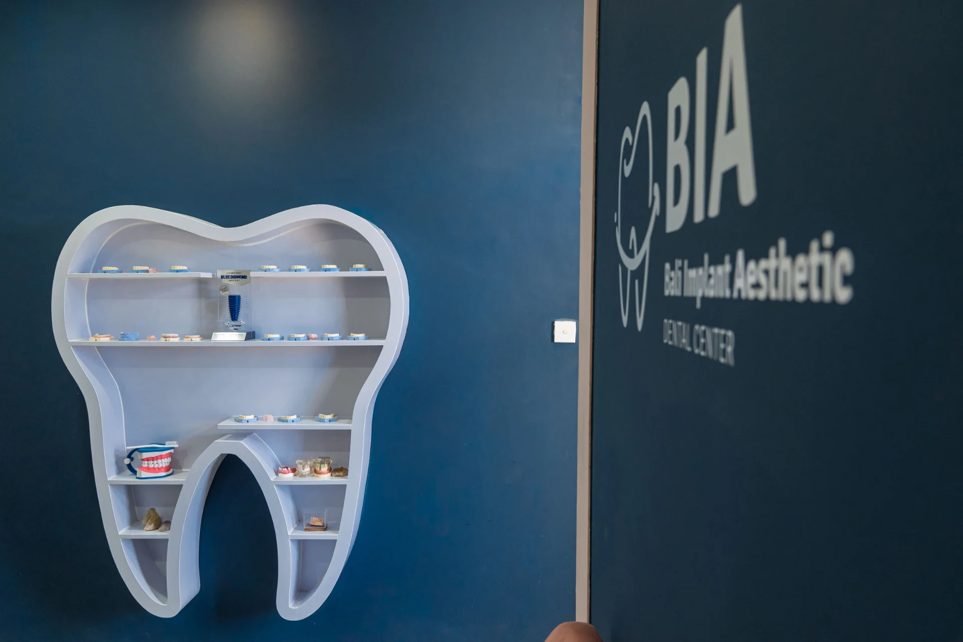 Best Place for Dental Implants in Bali